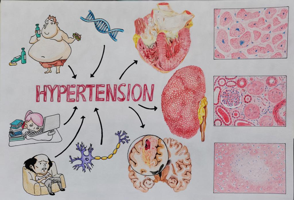 1. 邮寄手绘 作品分类 2 高血压的“前因后果” 男同性恋av
 鲁逸名